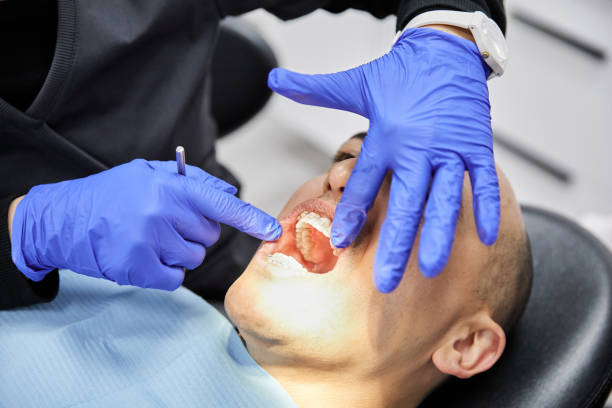 Best Emergency Dentist for Lost Fillings or Crowns in Machesney Park, IL