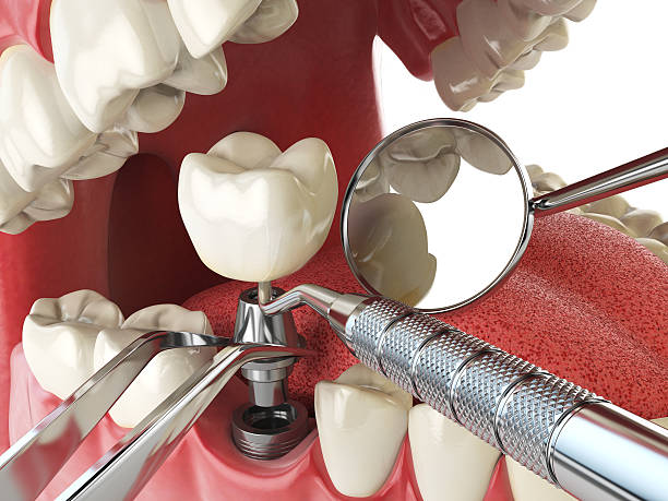 Best Broken or Cracked Tooth Emergency Dentist in Machesney Park, IL
